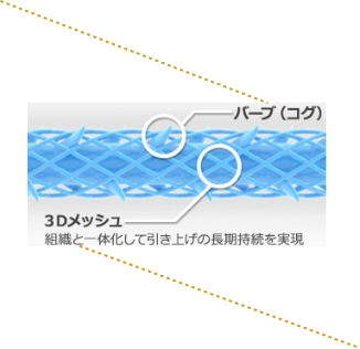 バーブ（コグ）　3Dメッシュ