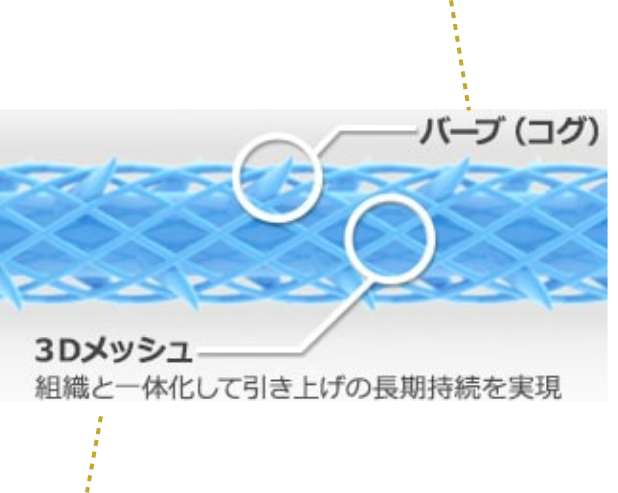 バーブ（コグ）　3Dメッシュ