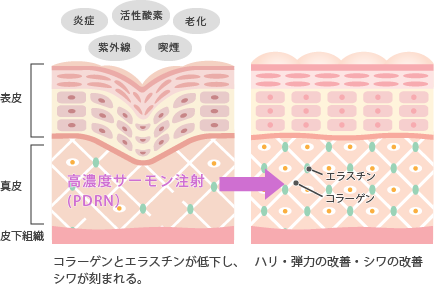 サーモン注射とコラーゲンの活性化