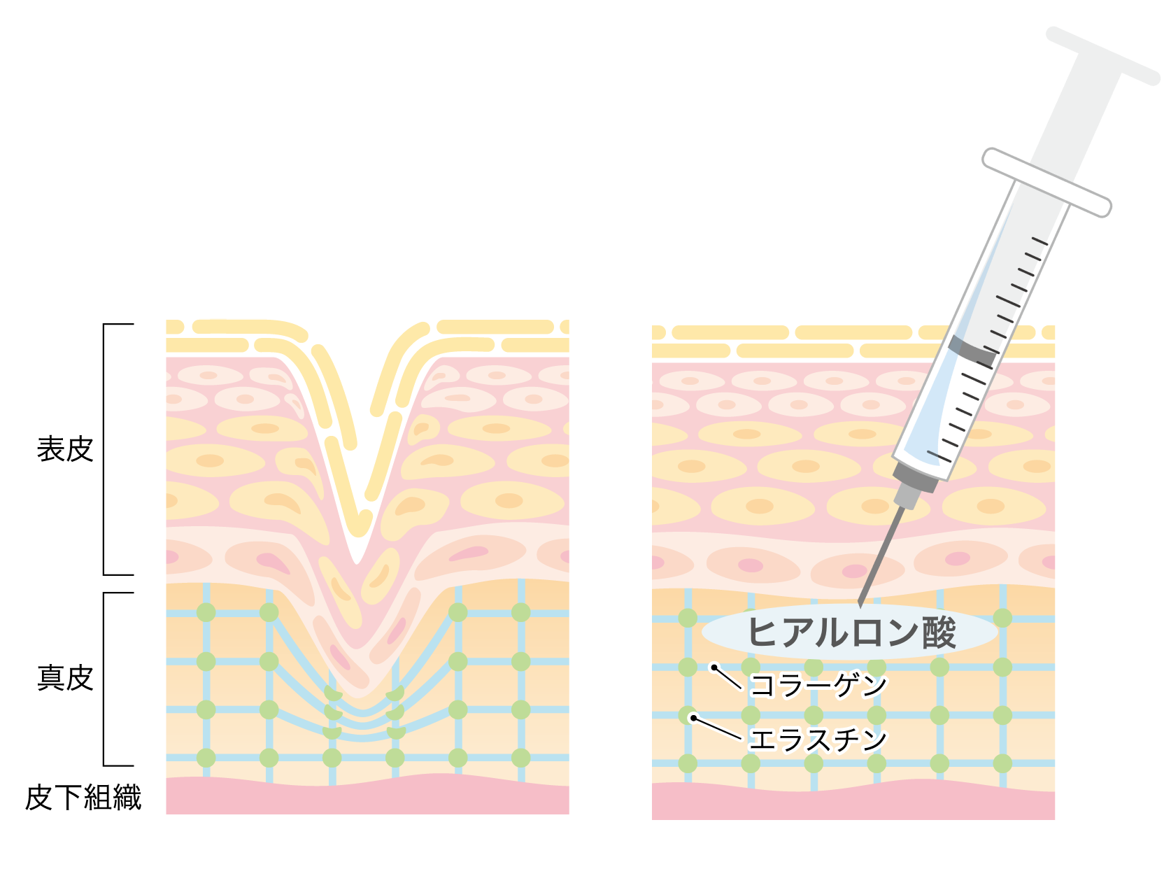 イメージ図